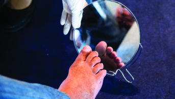 Clinician check a man's foot using a mirror