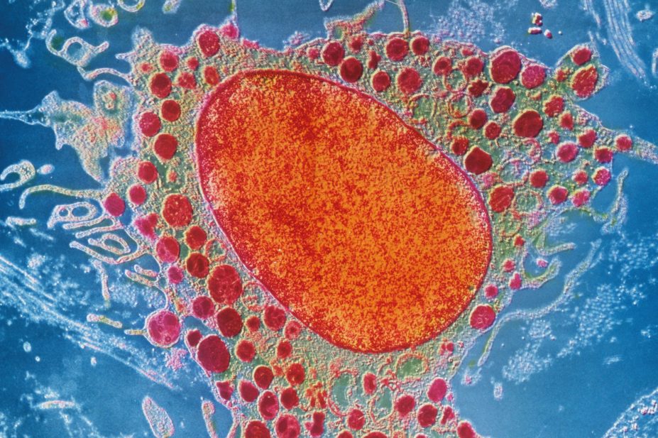 Micrograph of a mast cell