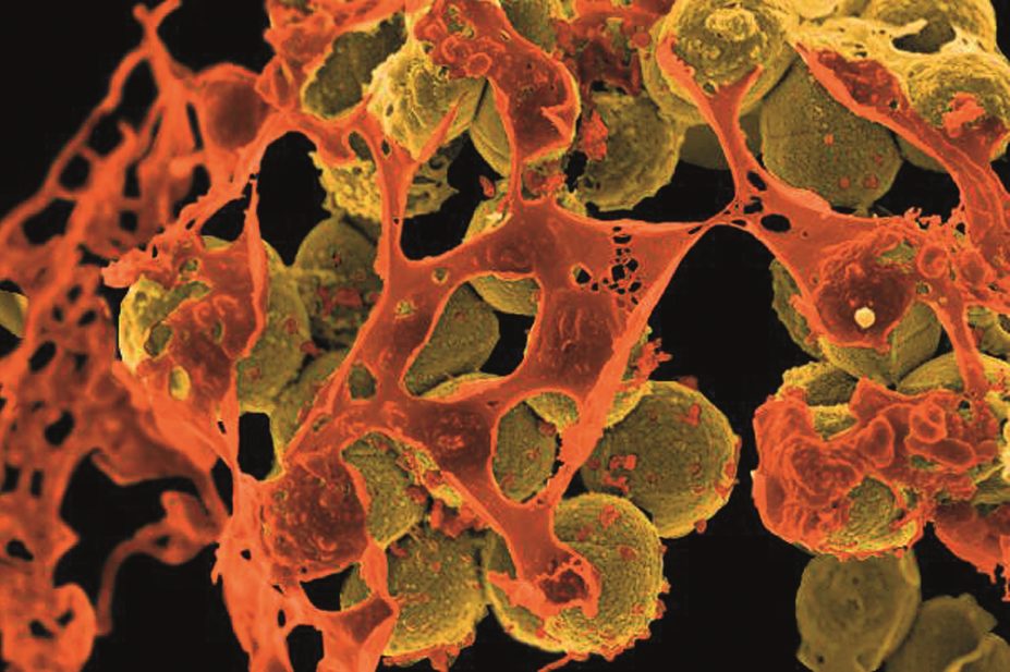 Micrograph of methicillin-resistant staphylococcus aureus (MRSA)