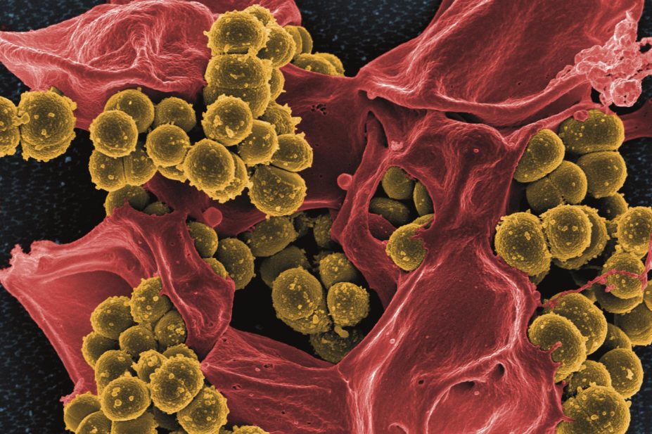 Researchers describe how a mathematical model calculates odds of resistance developing during antibiotic treatment, applicable to many species of resistant bacteria. Pictured, a scanned electron micrograph of meticillin resistant Staphylococcus aureus