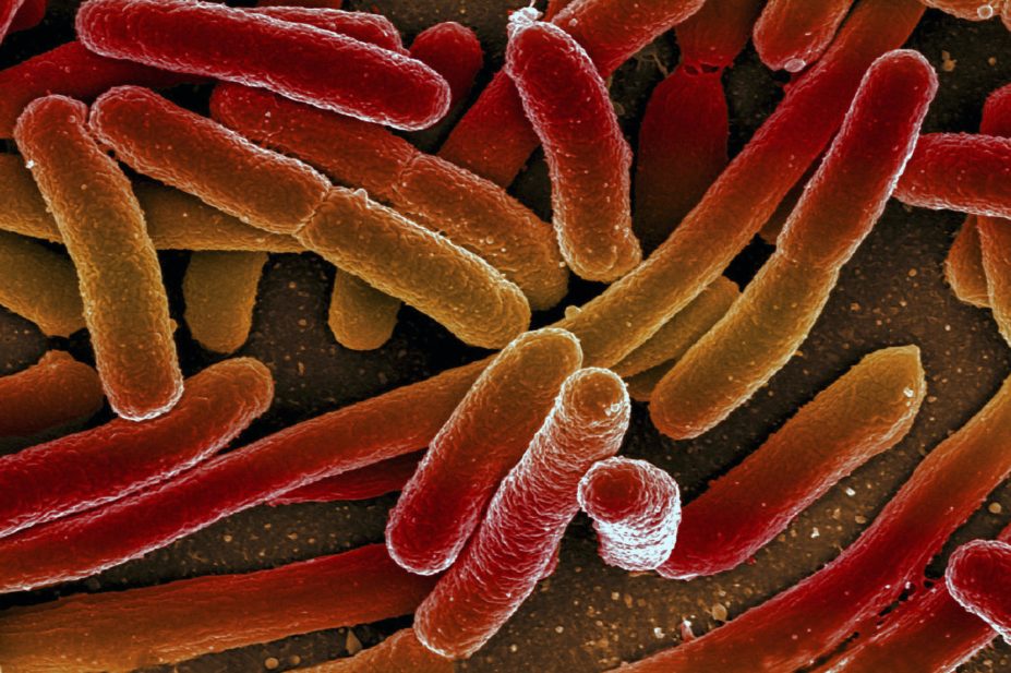 Micrograph of Escherichia coli
