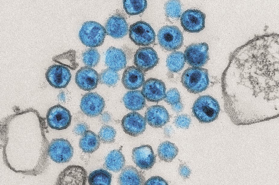 Micrograph of HIV virus
