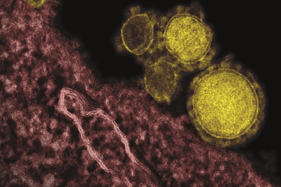 New case of Middle East Respiratory Syndrome Coronavirus (MERS-CoV) confirmed in Austria