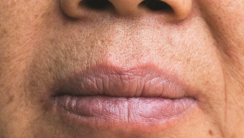 Close up of a senior woman's mouth