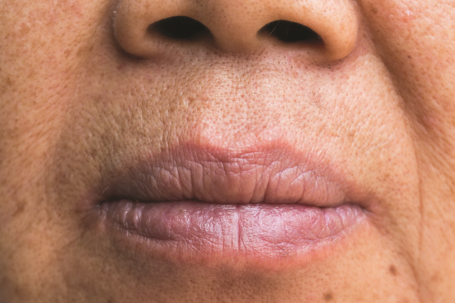 Close up of a senior woman with her mouth open Stock Photo 