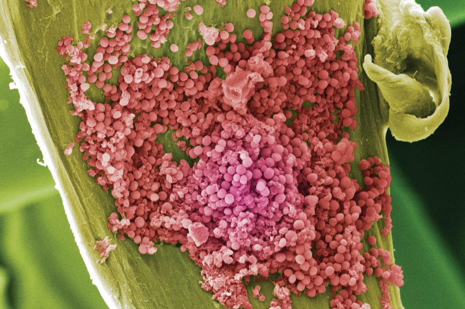 Scanning electron micrograph of methicillin-resistant Staphylococcus aureus (MRSA) bacteria