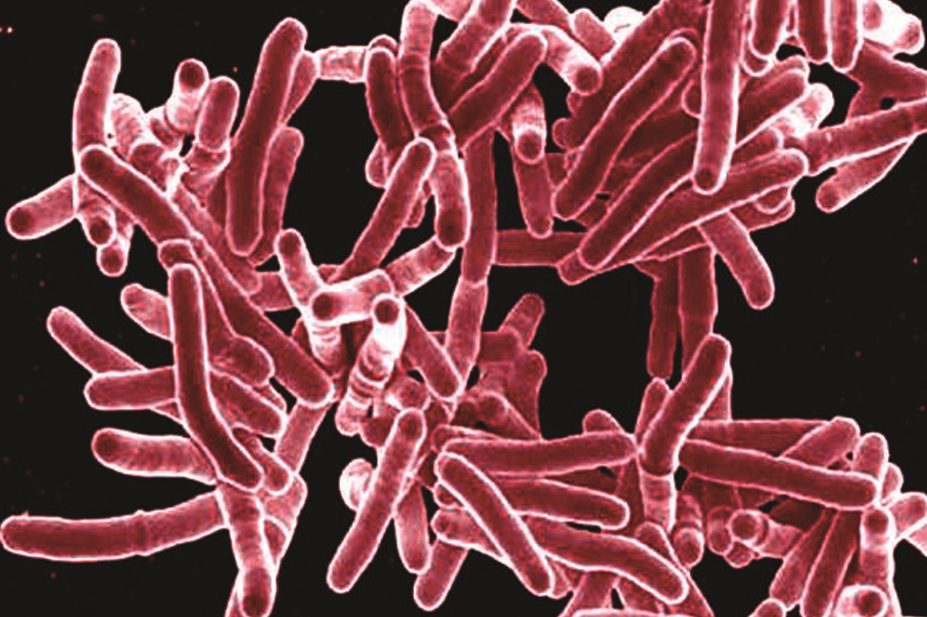 Researchers indicate that a modified mycobacterium could be developed as a novel vaccine candidate. In the image, micrograph of mycobacterium tuberculosis