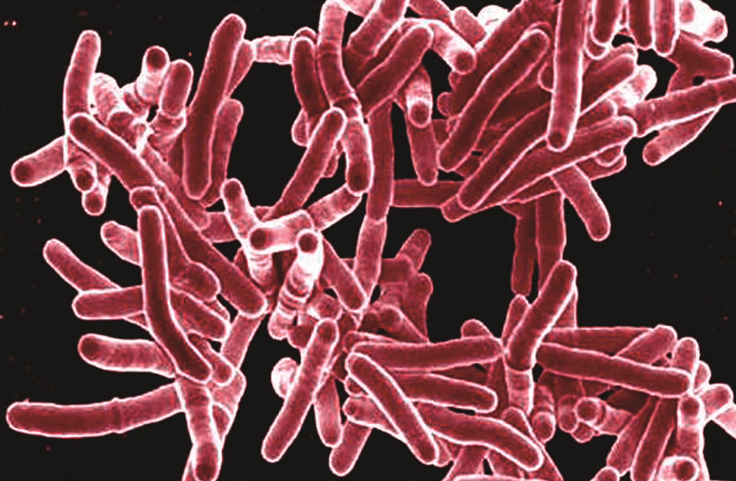 Микобактерии палочка. Палочка Коха (Mycobacterium tuberculosis). Палочка Коха под микроскопом. Палочка Коха микробиология. Микобактерия палочки Коха.