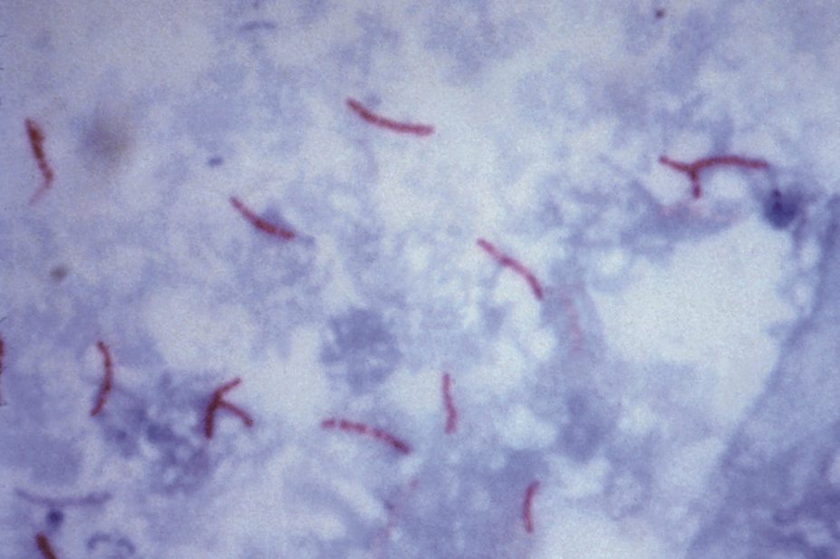 The upper age limit for treating adults with latent tuberculosis (TB) has been increased from 35 years to 65 years in updated guidelines released by NICE. In the image, micrograph of Mycobacterium tuberculosis bacteria