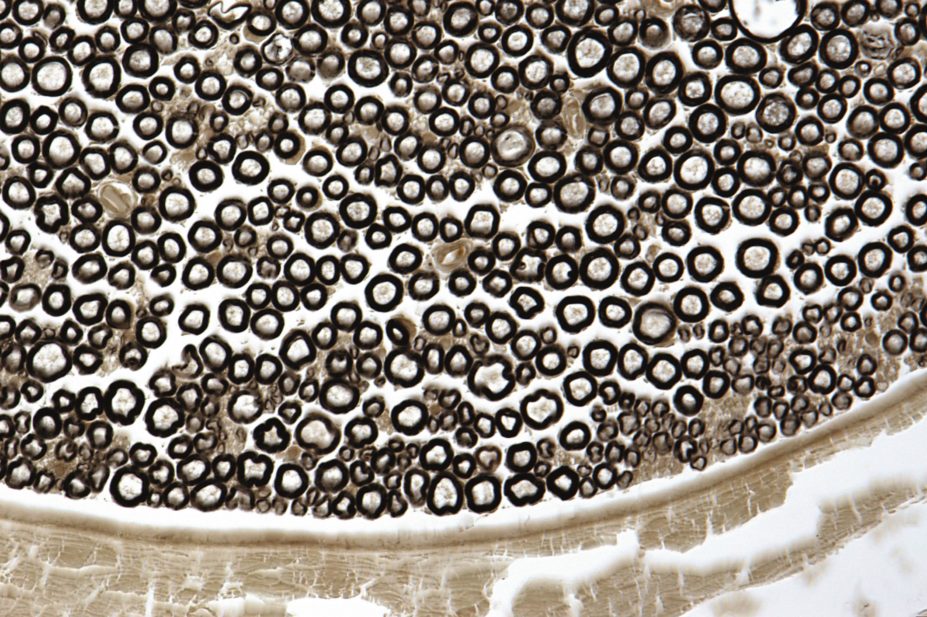 Micrograph of a cross section of the myelin sheath