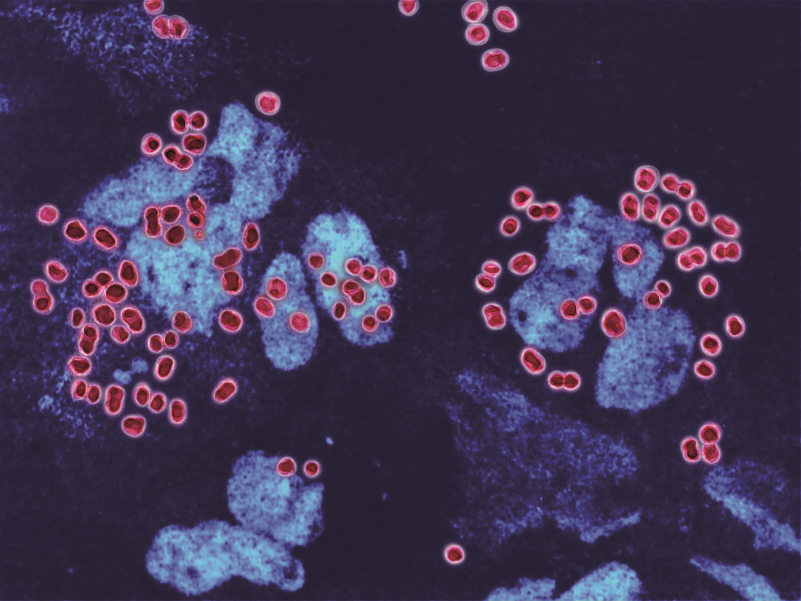 Gonorrhoea Is Becoming More Resistant To Antibiotics The   Neisseria Gonorrhoeae Gonorrhoea Bacteria Resistant Antibiotics 14 Scaled 