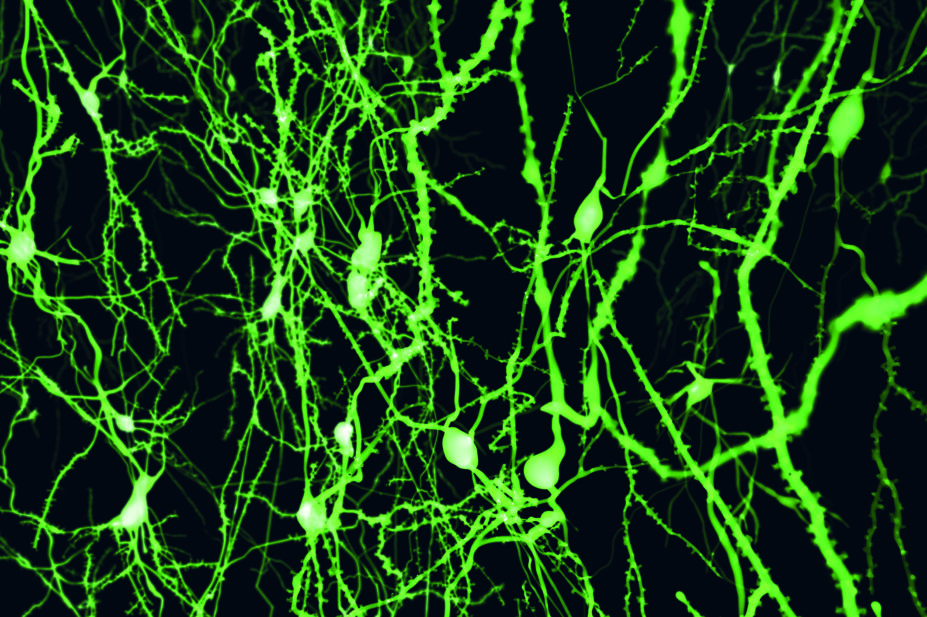 Fluorescence imaging of neurons in cortex of the brain