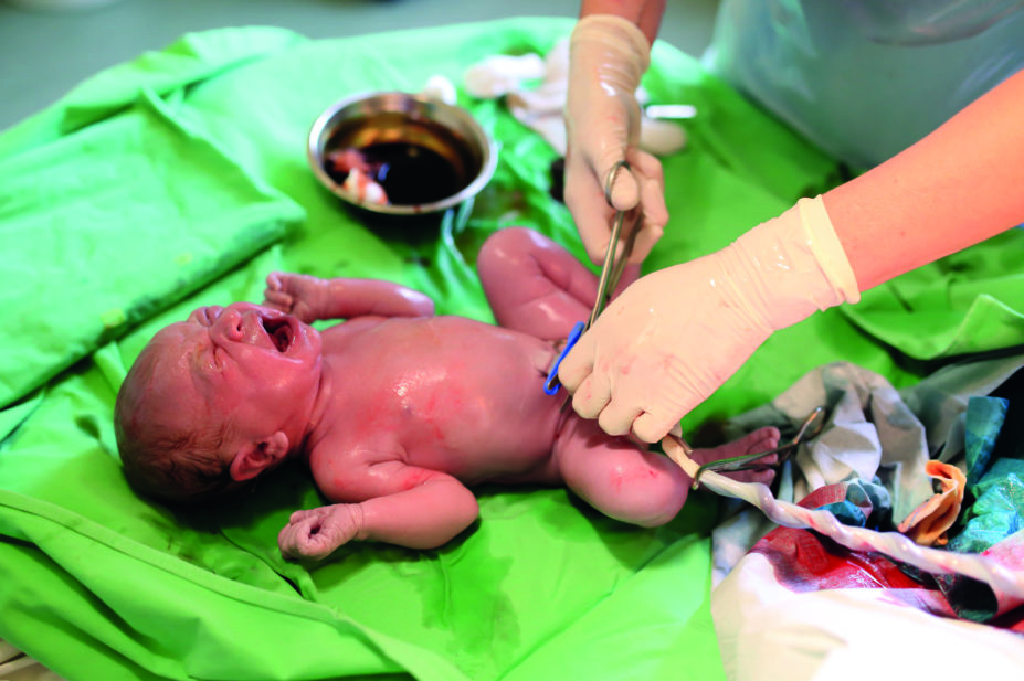 Nurse cutting umbilical cord of newborn baby