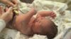 Newborn deaths can be reduced by cleaning umbilical stump with chlorhexidine, recent study finds