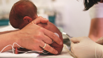 Lumbar puncture being performed on a newborn baby