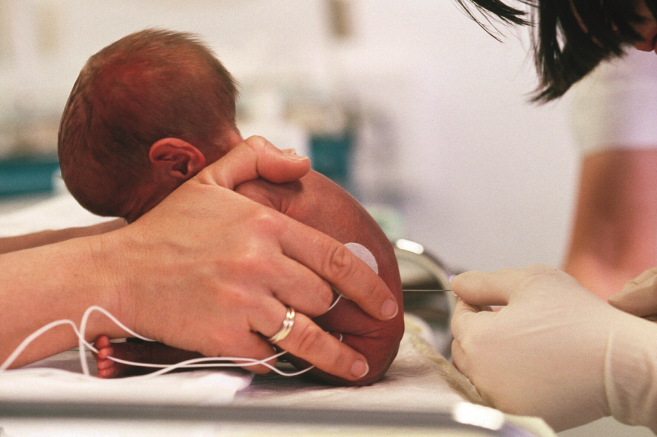 Lumbar puncture being performed on a newborn baby