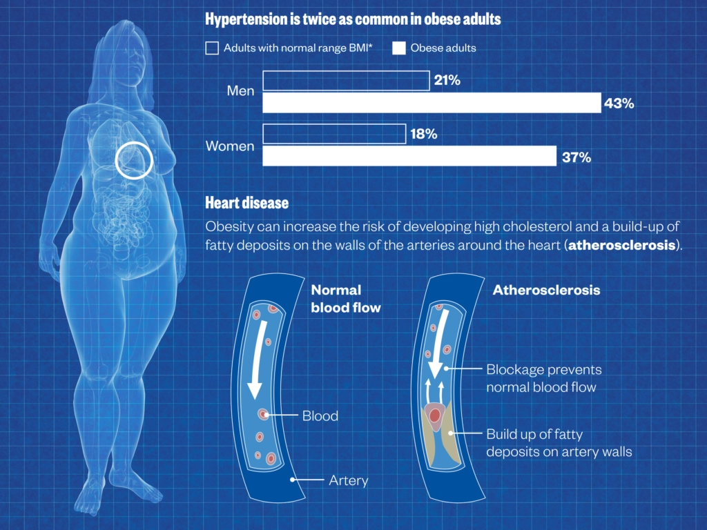 Charting obesity   The Pharmaceutical Journal