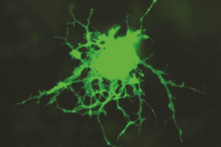 Stem cells in the central nervous system known as oligodendrocyte progenitor cells (pictured) are abundant in patients with multiple sclerosis (MS) but fail to differentiate.
