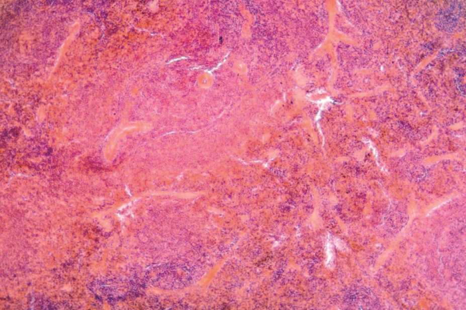 Micrograph of pancreas tissue