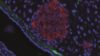 Scientists have highlighted the potential for repurposing denosumab, an osteoporosis drug, to treat diabetes and stimulate beta-cell replication. In the image, islet of Langerhans (in a mouse model) with insulin in red