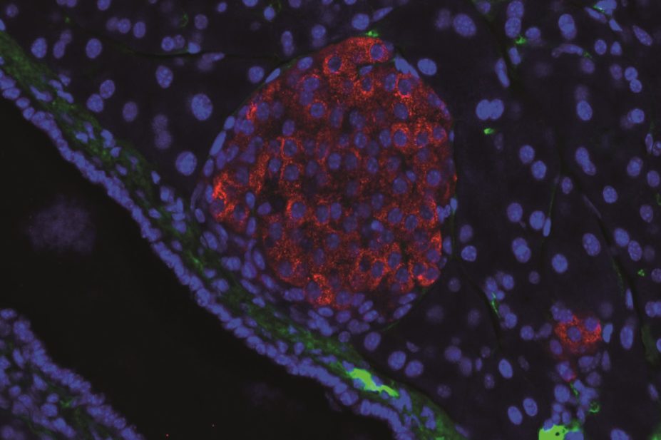 Scientists have highlighted the potential for repurposing denosumab, an osteoporosis drug, to treat diabetes and stimulate beta-cell replication. In the image, islet of Langerhans (in a mouse model) with insulin in red