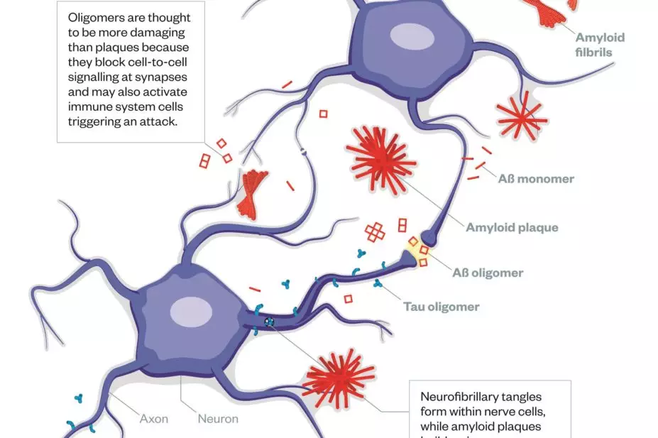 Oligomers are thought to be more damaging than plaques because they block cell-to-cell signalling at synapses and may also activate immune system cells triggering an attack. Neurofibrillary tangles form within nerve cells, while amyloid plaques build up i