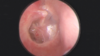 Managing common ear problems: discharge, ache and dizziness