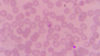 Micrograph of the plasmodium falciparum virus