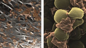 Platelet-disguised nanoparticles could enhance drug delivery. In the image, SEM images of platelet-membrane-coated nanoparticles (orange) binding to the lining of a damaged artery (left) and to MRSA bacteria (right)