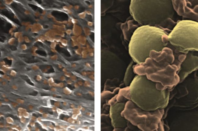 Platelet-disguised nanoparticles could enhance drug delivery - The ...