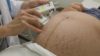 Researchers conducted a randomised controlled trial of metformin in pregnant obese women, but the drug did not reduce birthweight or pregnancy complications. In the image, a doctor checks the heart rate of a foetus