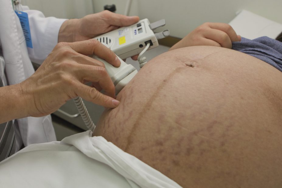 Researchers conducted a randomised controlled trial of metformin in pregnant obese women, but the drug did not reduce birthweight or pregnancy complications. In the image, a doctor checks the heart rate of a foetus