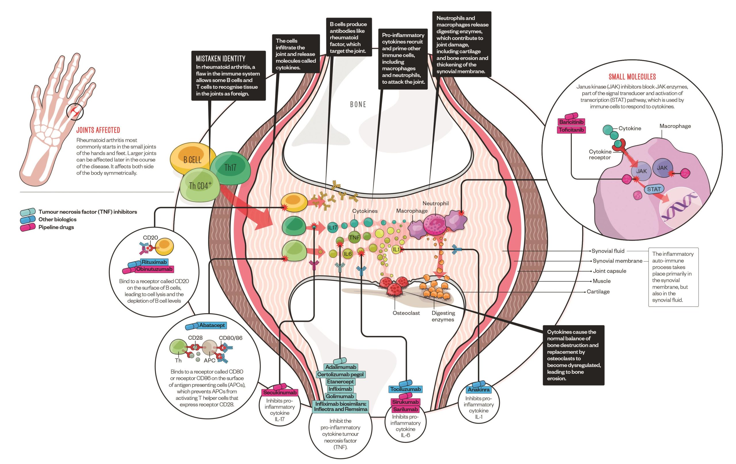 blocking-the-immune-system-in-rheumatoid-arthritis-the-pharmaceutical