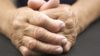 Hands showing symptoms of rheumatoid arthritis
