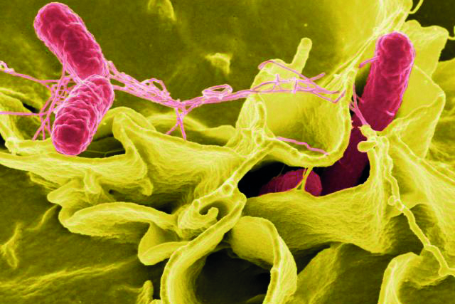 Salmonella bacteria, micrograph