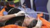 Senior woman receives emergency oxygen in an ambulance