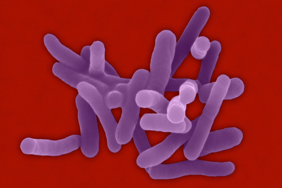 Micrograph of Shigella bacteria