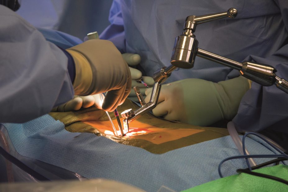 Cervical spine surgery is most commonly performed for myelopathy or radiculopathy and involves an anterior cervical discectomy and fusion. In the image, close-up of doctors performing spine surgery on patient