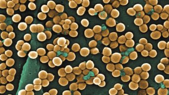 Researchers have developed polymeric nanoparticles loaded with the antibiotic clarithromycin which were able to reach Staphylococcus aureus (pictured) located inside individual lung cells, without toxic effects