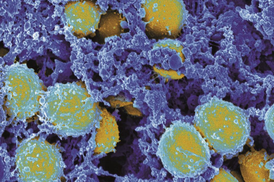 Researchers are developing antibodies armed with antibiotics that can target and kill the bacteria, such as Staphylococcus aureus, (micrograph pictured) concealed in the white blood cells