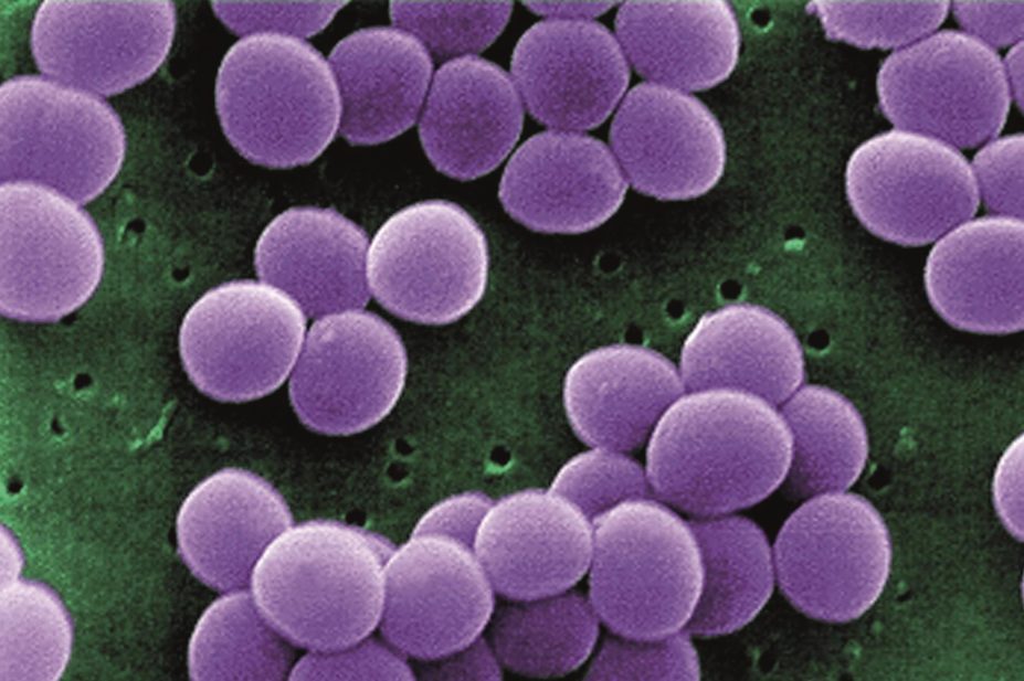 New endolytic enzyme called Staphefekt found to kill meticillin-resistant Staphylococcus aureus (pictured)