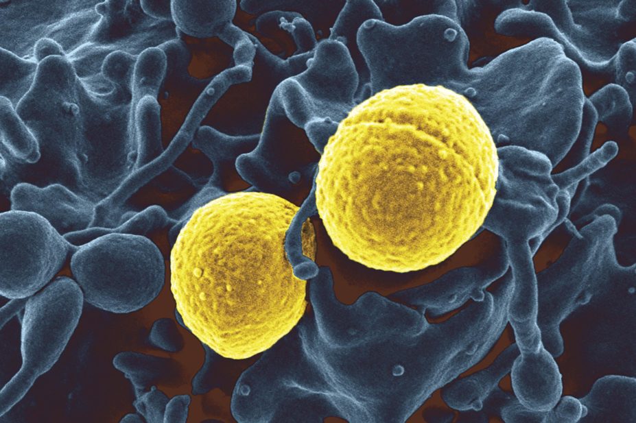 Anthelmintic drugs niclosamide and oxyclozanide can target multi-drug-resistant strains of Staphylococcus aureus (pictured in gold outside a white blood cell, in blue)