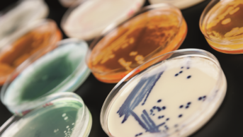 Enterobacter cloacae, Enterococcus faecalis, Staphylococcus epidermidis and Escherichia coli on a petri dish
