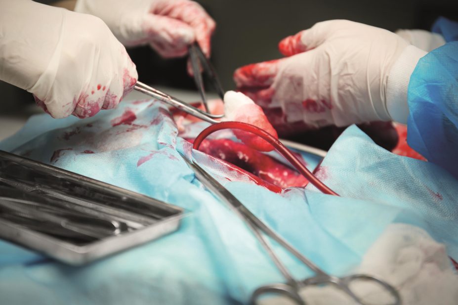 Close up of organ transplant surgery