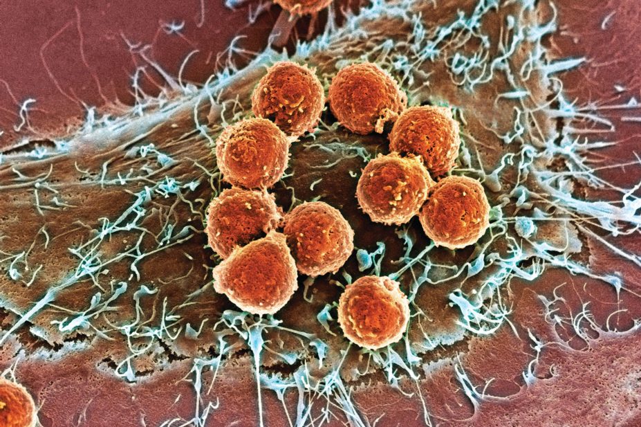 Micrograph of T cells attacking cancer cell