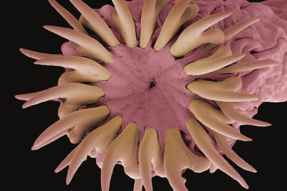 Un vierme sub microscop. Localizarea unui vierme local în corpul uman