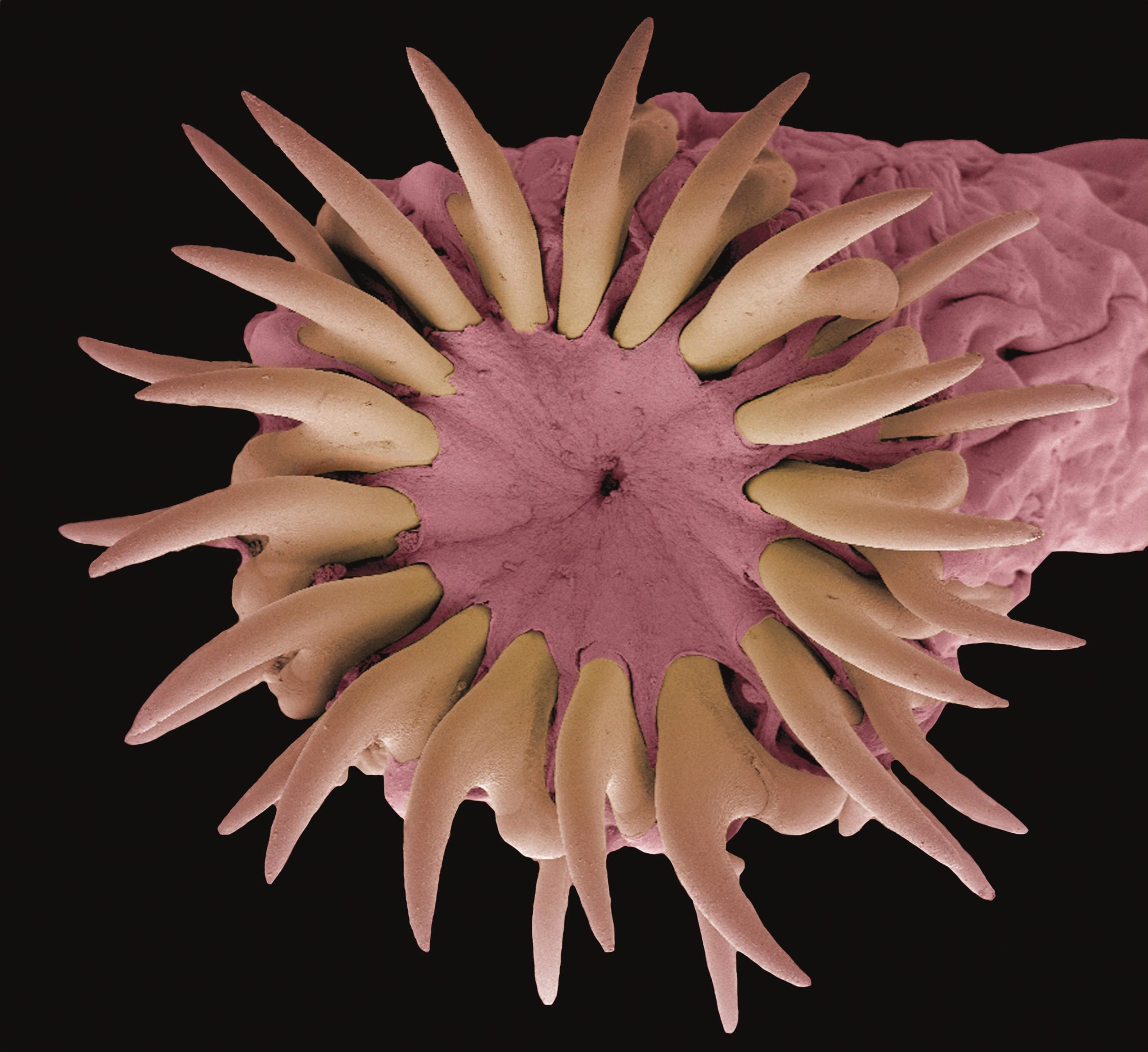 cum se poate elimina papilomul oblong papiloame ale verucilor genitale