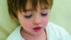 Toddler with chicken pox