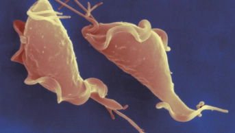 Scanning electron micrograph (SEM) of Trichomonas vaginalis parasite