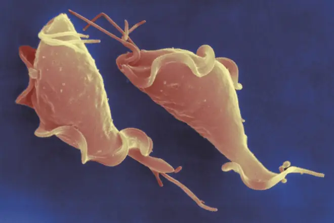 Image of "Scanning electron micrograph (SEM) of Trichomonas vaginalis, a non-viral sexually transmitted infection (STI). Symptoms usually develop within a month of infection, although the majority of infected men and women are asymptomatic."